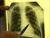 �� ������ ��������� �������� ������ ������ ���� ������ ��������������� ����� ��� ������